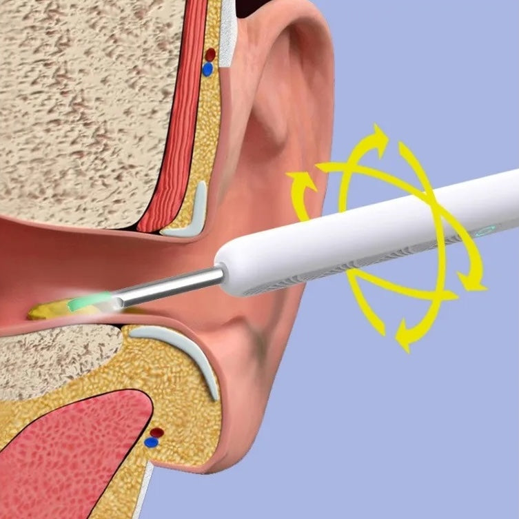 Otoscopio Limpiador de Oídos Youcare®